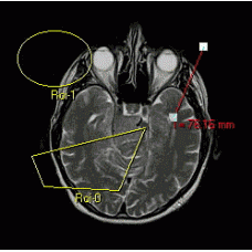 医学图形组件TDICOMCAD